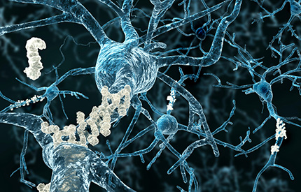 protein-beta-amyloid-in-Alzheimers-disease-430x275