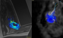 PerinatalImaging_224x135