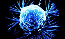 cancer-cell_224x135