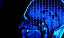 Brain