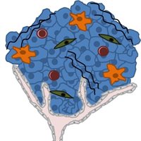 Immune cells infiltrate tumours