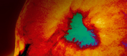 breast tissue_430x191