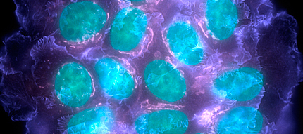 cancer cell_430x191