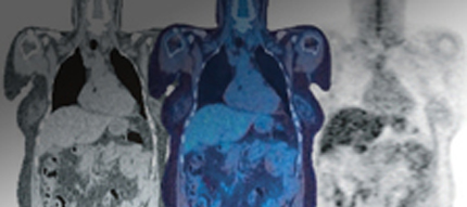 cancer imaging_430x191