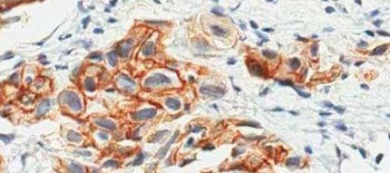 experimental oncology 430x191