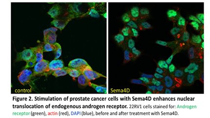 Prostate Cancer Research Centre Metastasis Group