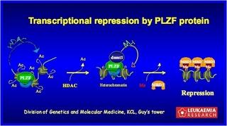 PLZFrepressionFGuidezsm