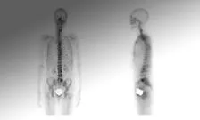 224x135Musculoskeletal