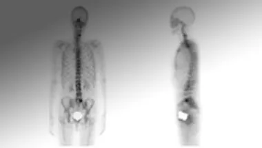 224x135Musculoskeletal