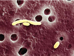 Ecoli