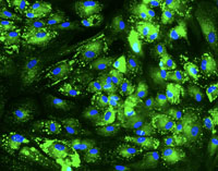 stemcell2