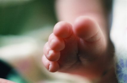 breastfeeding-eczema