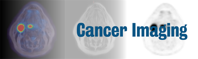 Cancerupdated