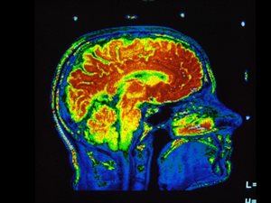 MNI_MRI