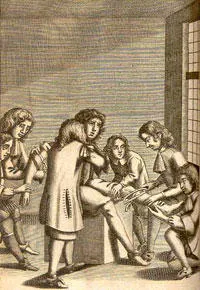 John Browne. Preternatural tumours, 1678.
