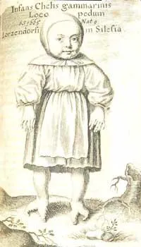 Infant from 'Gammarologia, sive, Gammarorum'