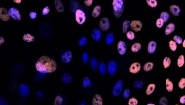 A heart of stem cells  Description: The image shows a heart-shaped colony (small compact nuclei, blue) containing human epidermal stem cells and their progeny, growing on a feeder layer of fibroblast cells (large nuclei, blue). Stem cells are labelled wit