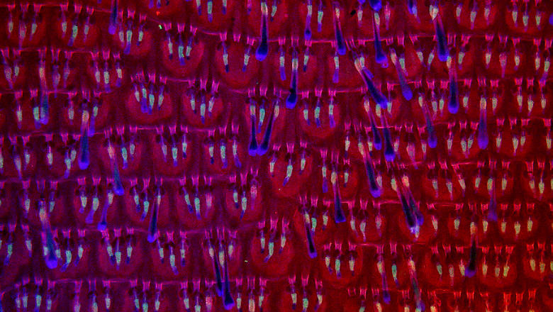 "Garden under the skin".  Adult mouse epidermal wholemount shows patterned arrangement of hair follicles in rows. Antibodies against Keratin 14 (red) was used to reveal epidermal basal layer, sebaceous glands and Keratin 15 (green) was used to show the st