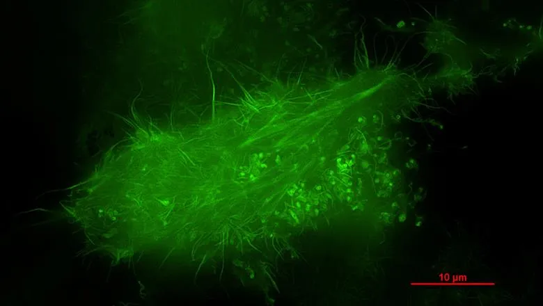 A SIM image of a living HeLa cell