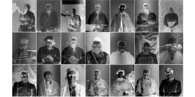 Cyanide portraits of Horton patients 