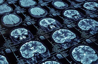 brain-scan