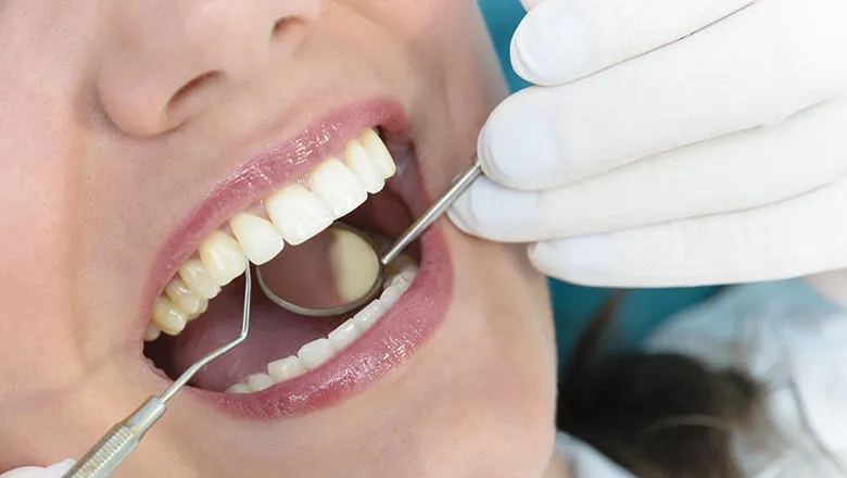 Picture of person with an open mouth at the dentist