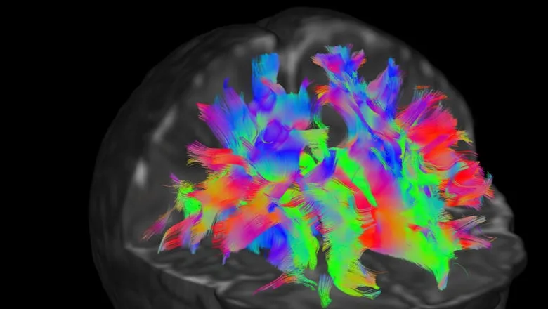 Baby brain scan