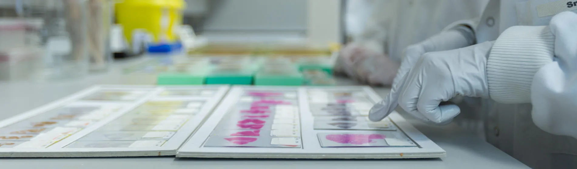 IoPPN student in a lab at King's College London