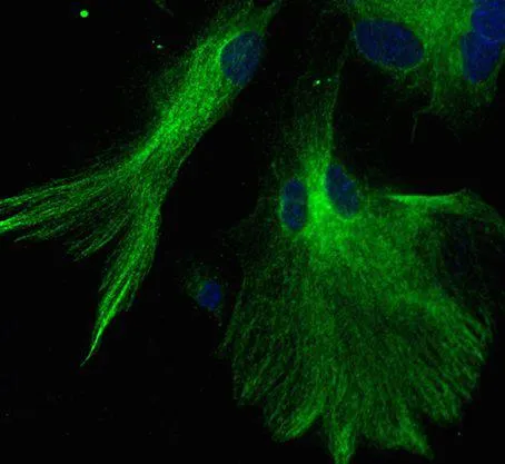 Glial cells and Neurodegeneration 