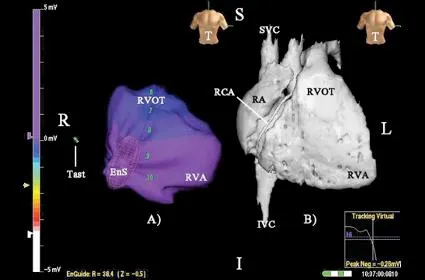 Electrophysiology