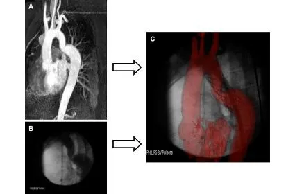 Interventional MR