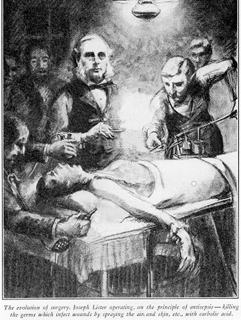 Lister_Operating