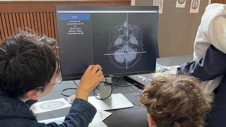 Festival of AI MRI