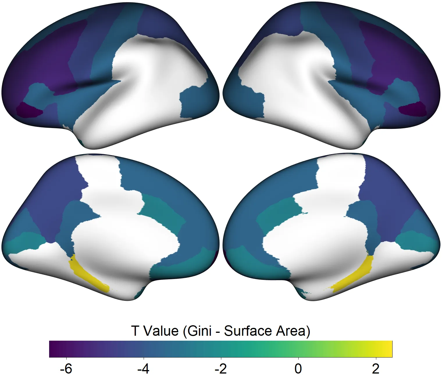 Computer image of brain scans