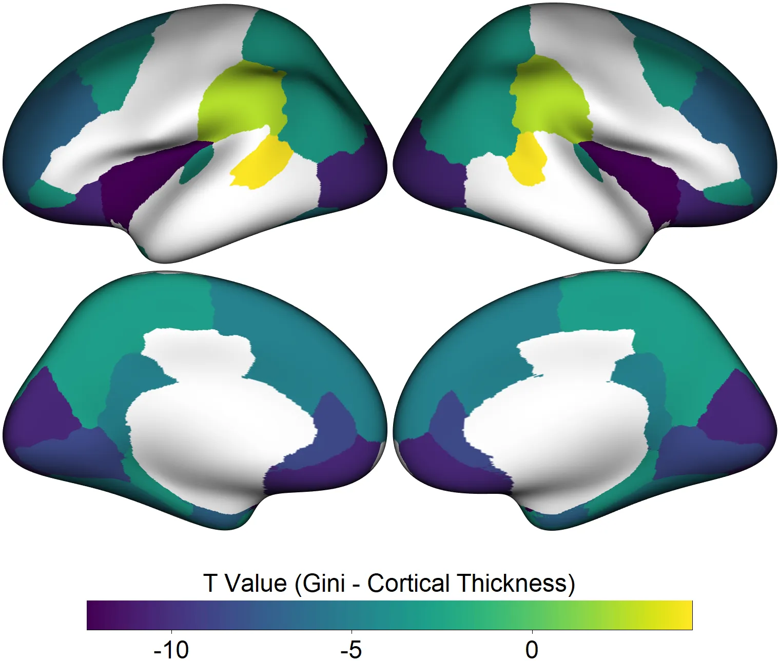 Computer image of four brain scans