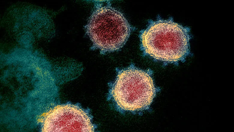 Image of a flu virus at the microscopic level