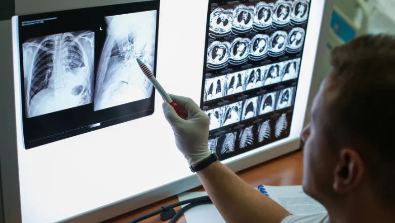 Carrying out a description of the radiographs of a patient with COPD