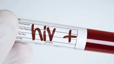 hiv aids blood test hero 1903x558