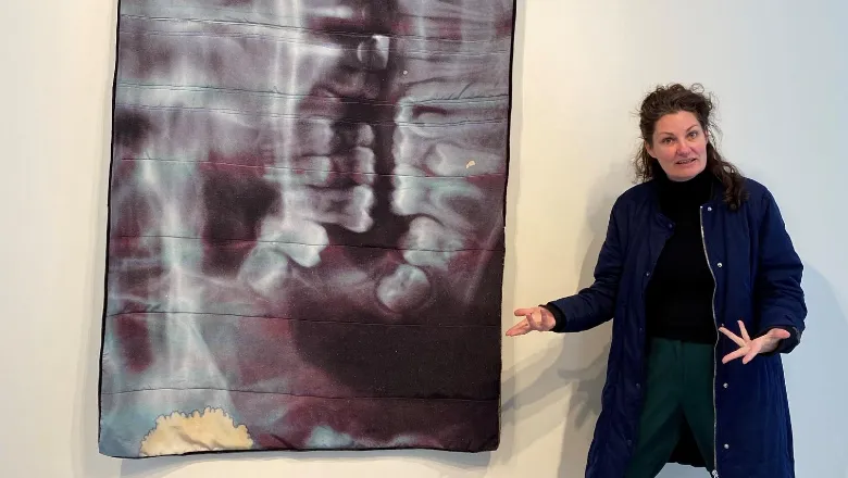 Dr Kate McMillan's new quilts are based on an x-ray and ultrasound images of her children