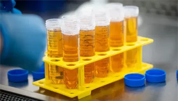 Understanding the genetic roots of aggressive childhood cancer: Research aims to improve Neuroblastoma treatment