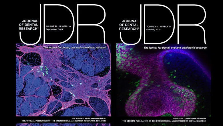 JDR Covers