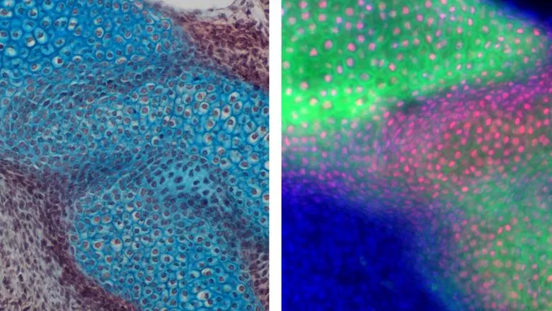 First image: the cartilages in blue, second image is the expression of Collagen type II in green and Sox9 in red