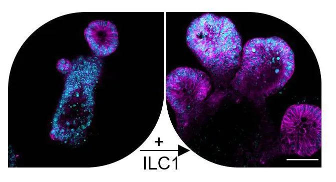 Organoids made from the small intestine express the receptor CD44 (magenta) in the stem cell crypt buds (left), but when ILC1 are added to the culture, these CD44-positive crypt buds grow, which could cause abnormal tumor growths in a chronically inflamed environment. – Geraldine Jowett