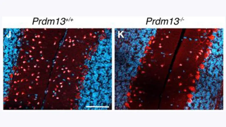 Prdm-13-image