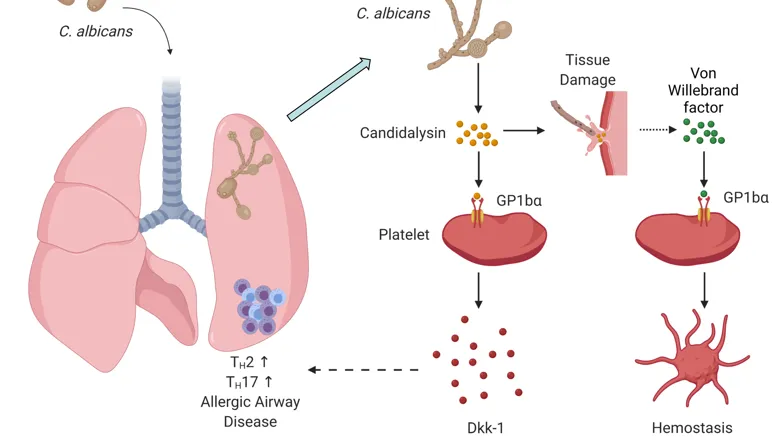 Clys-allergy MODEL