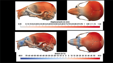 Researchers show genetic basis of facial changes in Down Syndrome