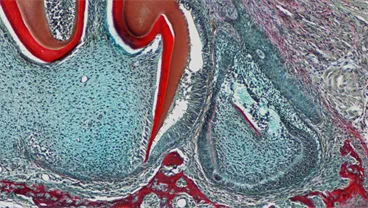 JDR Cover Story: Vascular Invasion of the Dental Epithelium Is Essential for Ameloblasts