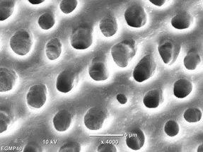 Dentine etched with an experimental primer