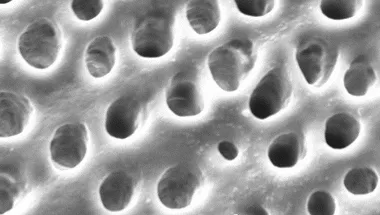 Dentine etched with an experimental primer