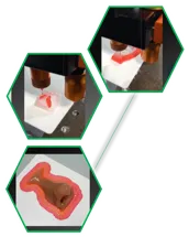 3D Printing of Facial/Body Prostheses
